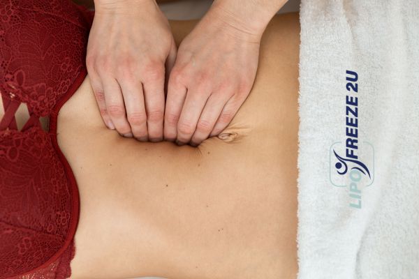 diastasis recti treatment Ashbourne