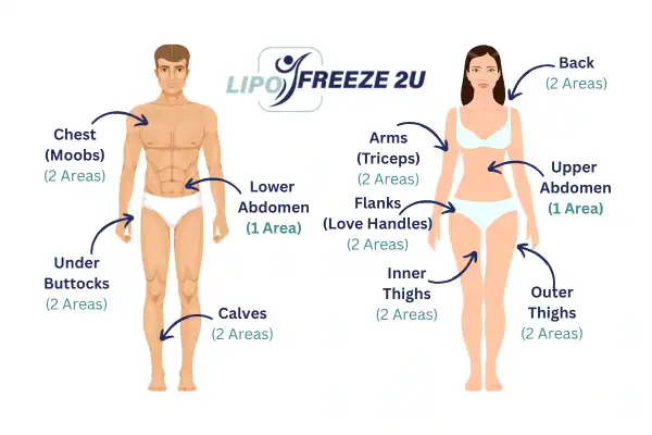 Areas you can have fat freezing treatment Ashbourne