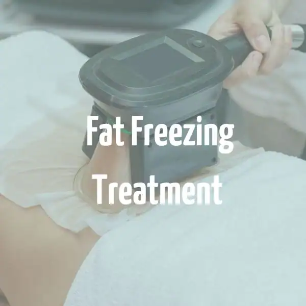 fat freezing treatment Ashbourne