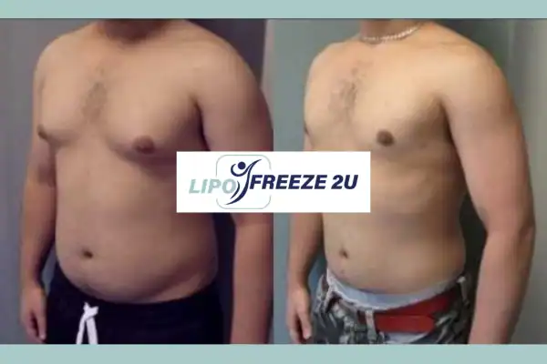 How Long Does It Take to See Results Ashbourne?